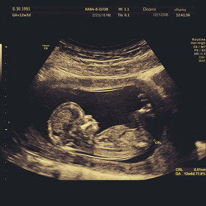 韩国免费高清观看熊出没
